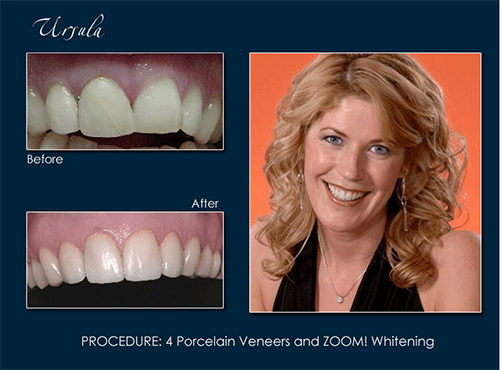 Dr. Richard Pape used teeth whitening to give Usrula a renewed smile