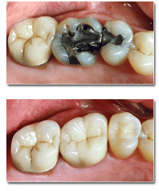 Integrity Dental - Crown and Bridges